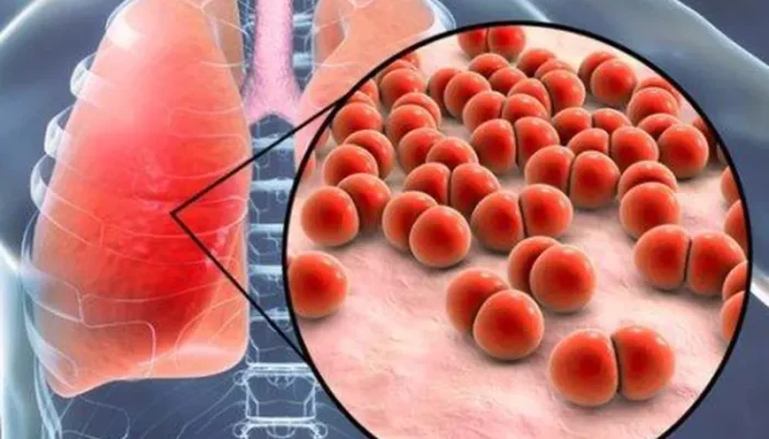 Mycoplasma Pneumoniae: Mengenal Bakteri Penyebab Pneumonia Misterius di China